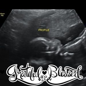 Meet your Posher, Larry